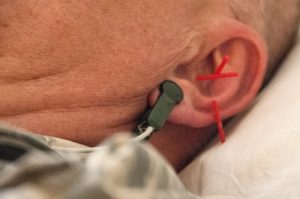 A soldier's ear with Alpha-Stim Earclips