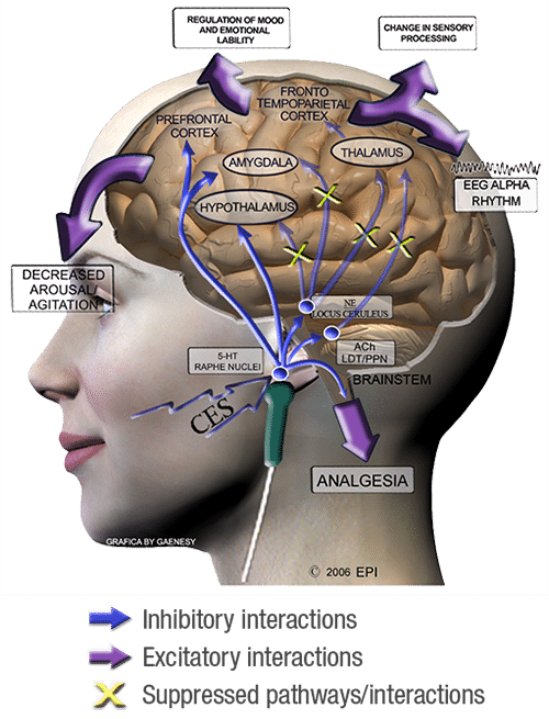 Waveform-Brain-Graphic1