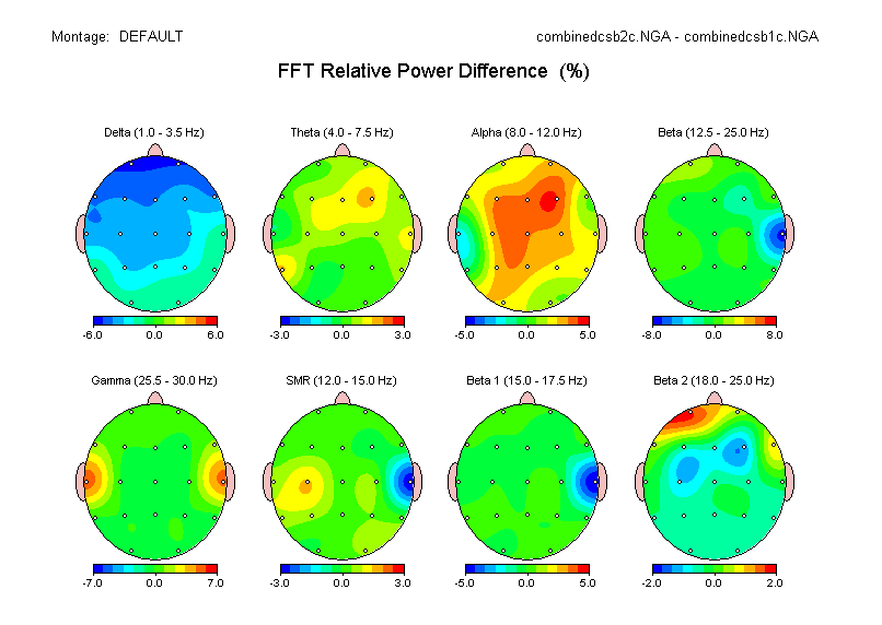 Results of the EEG study